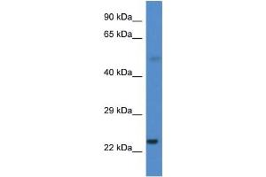 CYP1B1 antibody used at 0.