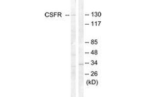 Western blot analysis of extracts from HT29 cells, using CSFR (Ab-809) Antibody.