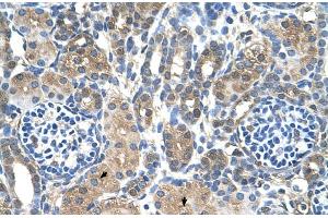 Human kidney (MTA2 anticorps  (C-Term))