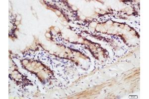 Formalin-fixed and paraffin embedded mouse intestine labeled with Rabbit Anti-CRNKL1 Polyclonal Antibody, Unconjugated  at 1:200 followed by conjugation to the secondary antibody and DAB staining. (CRNKL1 anticorps  (AA 201-300))