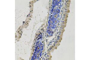 Immunohistochemistry of paraffin-embedded mouse lung using INHBB antibody (ABIN5995978) at dilution of 1/100 (40x lens). (INHBB anticorps)