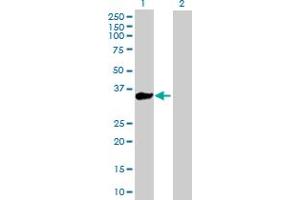 Western Blot analysis of KLHL3 expression in transfected 293T cell line by KLHL3 MaxPab polyclonal antibody. (KLHL3 anticorps  (AA 1-301))