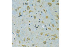 Immunohistochemistry of paraffin-embedded mouse brain using RPS7 antibody (ABIN5974069) at dilution of 1/100 (40x lens). (RPS7 anticorps)