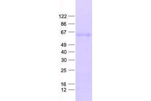 Validation with Western Blot
