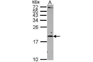 WB Image Sample (30 ug of whole cell lysate) A: Raji 15% SDS PAGE antibody diluted at 1:500 (IL-2 anticorps)