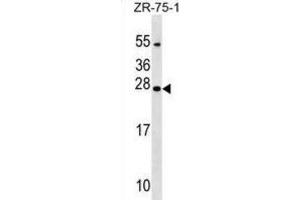 Western Blotting (WB) image for anti-Nucleoredoxin Like Protein 1 (NXNL1) antibody (ABIN2999692) (NXNL1 anticorps)