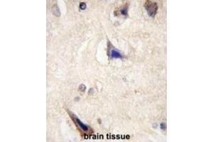 Immunohistochemistry (IHC) image for anti-Leucine-Rich Repeat Containing G Protein-Coupled Receptor 5 (LGR5) (Loop 1) antibody (ABIN3001605)