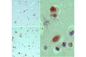 Image no. 1 for anti-Eukaryotic Translation Initiation Factor 3, Subunit G (EIF3G) (AA 50-100) antibody (ABIN960153)