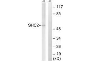Western blot analysis of extracts from Jurkat cells, using SHC2 Antibody. (SHC2 anticorps  (AA 261-310))