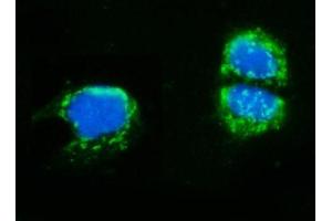 IF analysis of AMHR2 using anti-AMHR2 antibody (ABIN4886456).