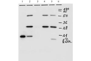 IP analysis of HPV-18 E7 protein. (HPV18 E7 anticorps  (AA 1-35))