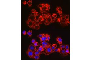 Immunofluorescence analysis of HepG2 cells using METTL7B Rabbit pAb (ABIN6128288, ABIN6143779, ABIN6143781 and ABIN6223026) at dilution of 1:100 (40x lens).