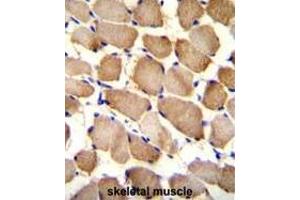 ARL17P1 Antibody (Center) immunohistochemistry analysis in formalin fixed and paraffin embedded human skeletal muscle followed by peroxidase conjugation of the secondary antibody and DAB staining. (ARL17A anticorps  (Middle Region))
