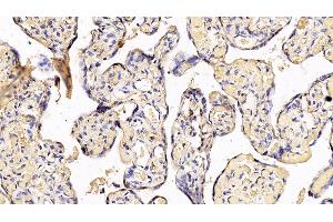 Detection of IFNa/bR2 in Human Placenta Tissue using Polyclonal Antibody to Interferon Alpha/Beta Receptor 2 (IFNa/bR2)