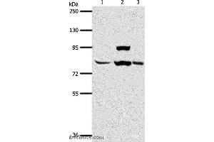 Western blot analysis of Human liver cancer tissue, hela cell and mouse lung tissue, using AGAP1 Polyclonal Antibody at dilution of 1:400