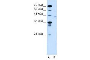 Image no. 1 for anti-Fukutin (FKTN) (AA 111-160) antibody (ABIN205072) (Fukutin anticorps  (AA 111-160))