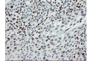 Image no. 7 for anti-Transcription Factor MafB (MAFB) (AA 32-320) antibody (ABIN1491411) (MAFB anticorps  (AA 32-320))