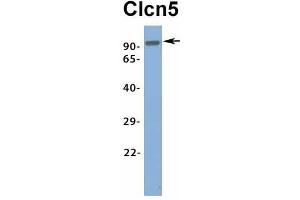 Host:  Rabbit  Target Name:  Clcn5  Sample Type:  Rat Brain  Antibody Dilution:  1.