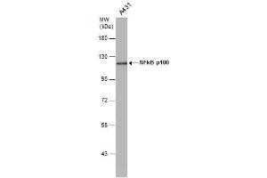 WB Image NFkB p100 antibody [C2C3], C-term detects NFkB p100 protein by western blot analysis.