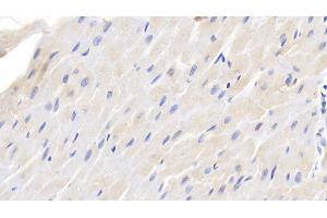 Detection of TGFb1 in Canine Cardiac Muscle Tissue using Polyclonal Antibody to Transforming Growth Factor Beta 1 (TGFb1)