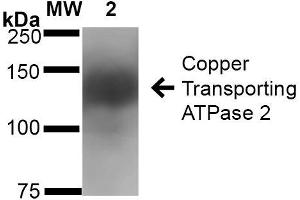 Western Blot analysis of Rat Brain Membrane showing detection of ~160 kDa Copper Transporting ATPase 2 protein using Mouse Anti-Copper Transporting ATPase 2 Monoclonal Antibody, Clone S62-29 . (ATP7B anticorps  (AA 3-21) (Atto 488))