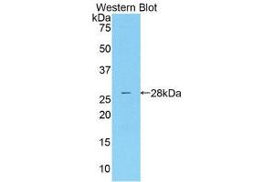 Western Blotting (WB) image for anti-Mannose Associated Serine Protease 2 (AA 445-683) antibody (ABIN1859763) (Mannose Associated Serine Protease 2 (AA 445-683) anticorps)