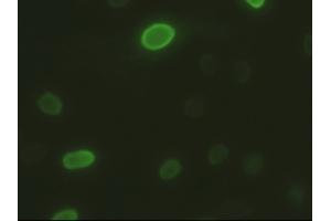 Anti-DFFA mouse monoclonal antibody (ABIN2452364) immunofluorescent staining of HeLa cells transiently transfected by pCMV6-ENTRY DFFA (RC202879)