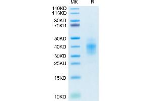 SDS-PAGE (SDS) image for NKG2C & CD94 protein (His-Avi Tag) (ABIN7275330)