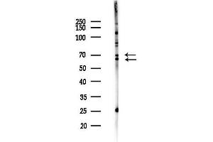 Western blot analysis of lysates from Hela cells(heat-shock,45 min treatment), using Ik3-1 Antibody at 1/1000 dilution.