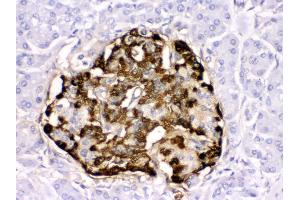 Anti- GLP1 Picoband antibody, IHC(P) IHC(P): Human Pancreatic Cancer Tissue (Glucagon anticorps  (N-Term))