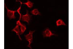 ABIN6272355 staining Hela by IF/ICC. (L1CAM anticorps  (C-Term))