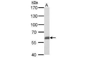 WB Image p63 antibody [N2C1], Internal detects TP63 protein by Western blot analysis.