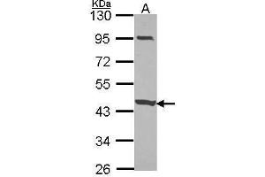 WB Image Sample (30 ug of whole cell lysate) A: JurKat 10% SDS PAGE CCDC83 antibody antibody diluted at 1:1000 (CCDC83 anticorps)