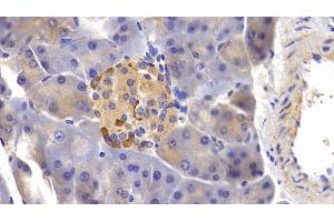 Detection of TNFRSF21 in Mouse Pancreas Tissue using Polyclonal Antibody to Tumor Necrosis Factor Receptor Superfamily, Member 21 (TNFRSF21)