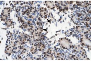 Rabbit Anti-GTF21 Antibody ,Paraffin Embedded Tissue: Human Pancreas  Cellular Data: Epithelial cells of pancreatic acinus  Antibody Concentration: 4. (GTF2I anticorps  (N-Term))