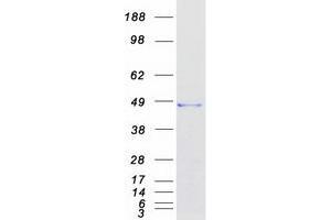 Validation with Western Blot
