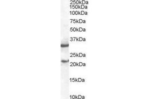 ABIN2560058 staining (2µg/ml) of mouse spleen lysate (RIPA buffer, 35µg total protein per lane). (SOCS1 anticorps  (C-Term))