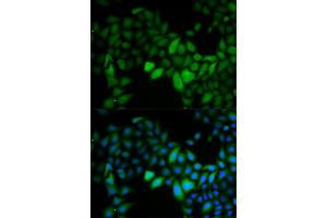 Immunofluorescence analysis of HeLa cells using TK1 antibody. (TK1 anticorps)