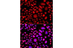 Immunofluorescence analysis of A549 cells using PRKAG3 antibody (ABIN5975719).