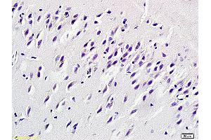 Formalin-fixed and paraffin embedded rat brain labeled with Rabbit Anti VEGF-A Polyclonal Antibody, Unconjugated (ABIN675893) at 1:200 followed by conjugation to the secondary antibody and DAB staining