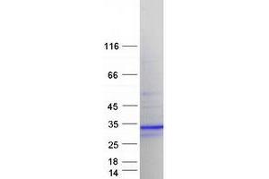 Validation with Western Blot