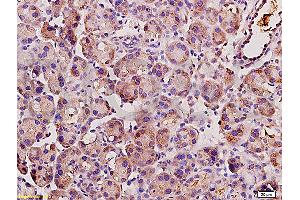 Formalin-fixed and paraffin embedded rat pancreas tissue labeled with Anti-Angiotensin II Polyclonal Antibody, unconjugated  (ABIN670521)  at 1: 200, followed by incubation with conjugated secondary antibody and DAB staining