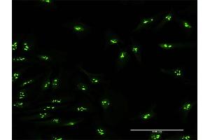 Immunofluorescence of purified MaxPab antibody to KIAA0020 on HeLa cell. (KIAA0020 anticorps  (AA 1-648))
