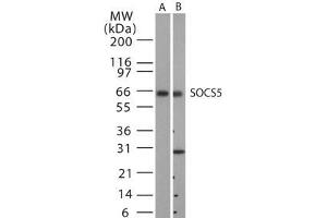 Image no. 1 for anti-Suppressor of Cytokine Signaling 5 (SOCS5) antibody (ABIN233231) (SOCS5 anticorps)