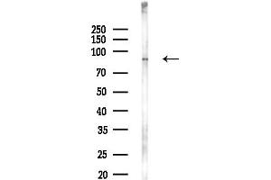 Western blot analysis of lysates from PC12 cells(LPS,4h treatment), using SLC9 Antibody at 1/1000 dilution.