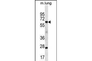 SP2 Antibody (C-term) (ABIN657045 and ABIN2837886) western blot analysis in mouse lung tissue lysates (35 μg/lane).