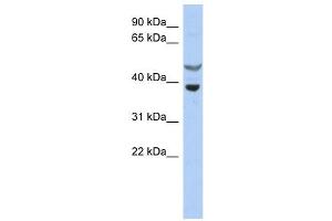 SOCS7 antibody used at 1 ug/ml to detect target protein. (SOCS7 anticorps  (N-Term))