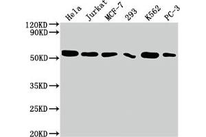 Western Blot Positive WB detected in: Hela whole cell lysate, Jurkat whole cell lysate, MCF-7 whole cell lysate, 293 whole cell lysate, K562 whole cell lysate, PC-3 whole cell lysate All lanes: CDC37 antibody at 1:2000 Secondary Goat polyclonal to rabbit IgG at 1/50000 dilution Predicted band size: 45 kDa Observed band size: 50 kDa (Recombinant CDC37 anticorps)