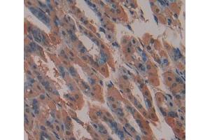 Used in DAB staining on fromalin fixed paraffin- embedded stomach tissue