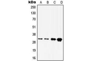 Western blot analysis of HOXD8 expression in A375 (A), A431 (B), HepG2 (C), HeLa (D) whole cell lysates. (HOXD8 anticorps  (C-Term))